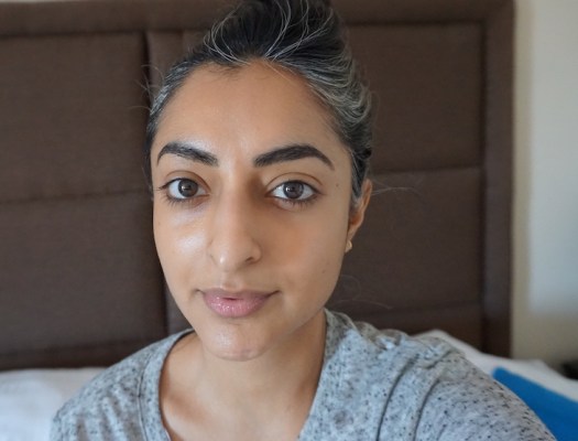 Pico Toning Laser Review, Dr Calvin Chan, skin rejuvenating treatments, anti ageing treatments, aesthetic treatments singapore